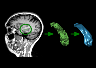 Hippocampus Analysis